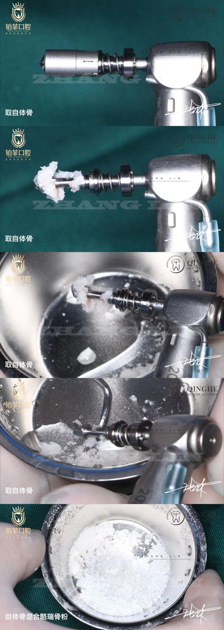 取骨钻详情1.jpg